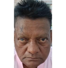 patient Image
